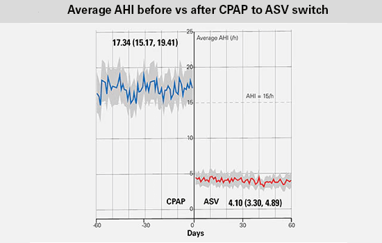 Grafik mit ASV Big Data und PAP-Nutzungsstunden vor und nach der Umstellung von CPAP auf ASV