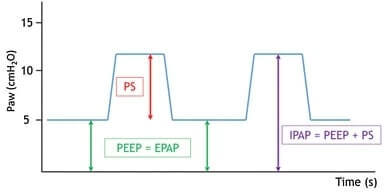 Grafik, die den Unterschied zwischen PS, PEEP und IPAP zeigt